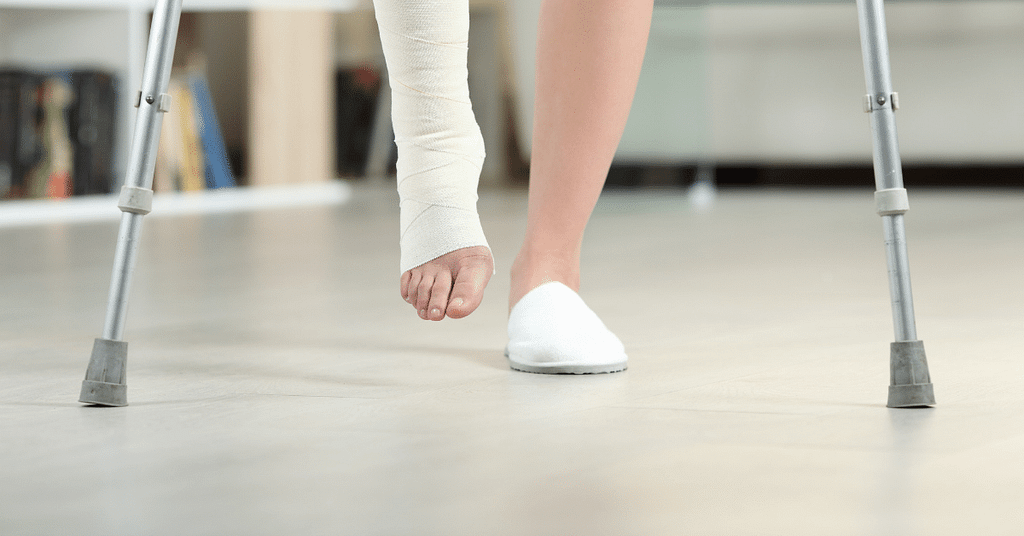 Recovering from a broken foot- 8 life hacks