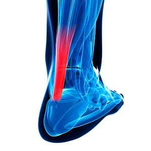 A graphic showing the Achilles tendon on a foot